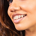 Eye-to-neck ¾ profile view of woman with clear braces smiling