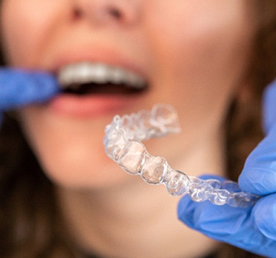 Dentist with blue gloves holding clear aligner in front of patient